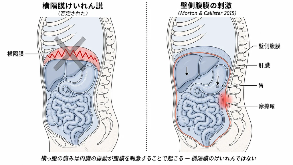 横っ腹の痛み(ETAP)の原因に関する 2 パネルの矢状断解剖比較図。左パネル:否定された横隔膜けいれん説、横隔膜上に赤いジグザグのけいれん波と半透明グレーの X 印が描かれ、この説が支持されていないことを示す。右パネル:Morton & Callister 2015 が支持する壁側腹膜刺激のメカニズム、腹膜の内壁がコーラル色で強調され、肝臓と胃の下向き矢印が着地時の内臓振動を示し、肝臓の靭帯付着部に赤い摩擦域が描かれる。5 つの解剖学的ラベル:横隔膜、壁側腹膜、肝臓、胃、摩擦域。